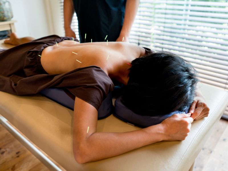 Acupuncture therapy